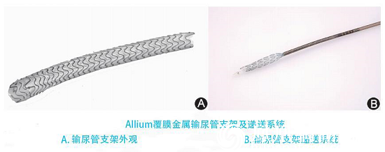 图左：绿色箭头示传统的输尿管支架管（其头端在肾脏内，尾端在膀胱内，因其两端卷曲形似英文字“J”而取名双J管）图右：绿色箭头示覆膜支架
