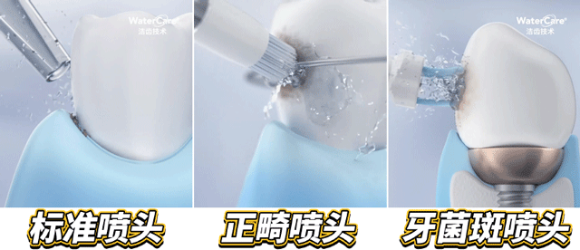 1秒清洁牙缝,牙齿问题不用怕,想吃啥就吃啥,省几万看牙钱