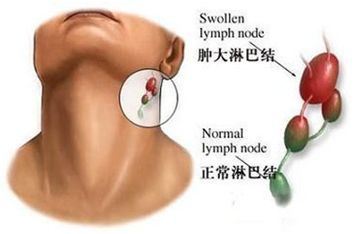 高危对象