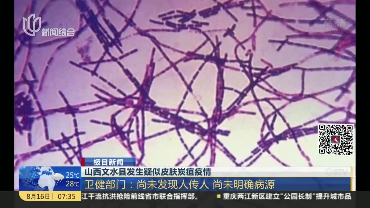 山西文水县发生疑似皮肤炭疽疫情：病例已隔离治疗