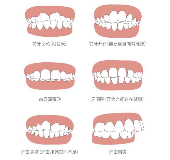 天津諾爾口腔醫院:成年人牙齒能矯正麼?