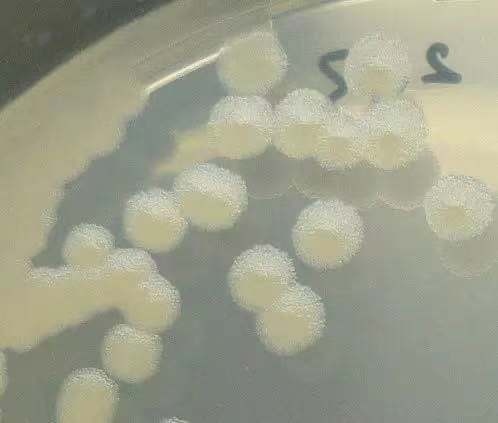 炭疽芽胞杆菌在普通培养基上的菌落形态 图源:中国疾控动态微信公号