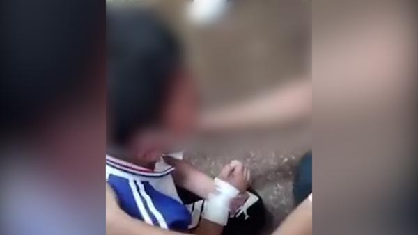 小学生疑被老师所伤，丽水龙泉教育局表示正在调解