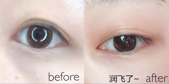 有水的眼罩怎么使用1片=蒸汽眼罩+燕窝眼膜，让眼睛“喝燕窝”_https://www.jmylbn.com_新闻资讯_第16张