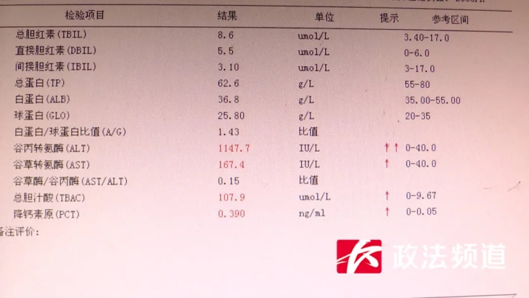 肝肾功能检查单图片