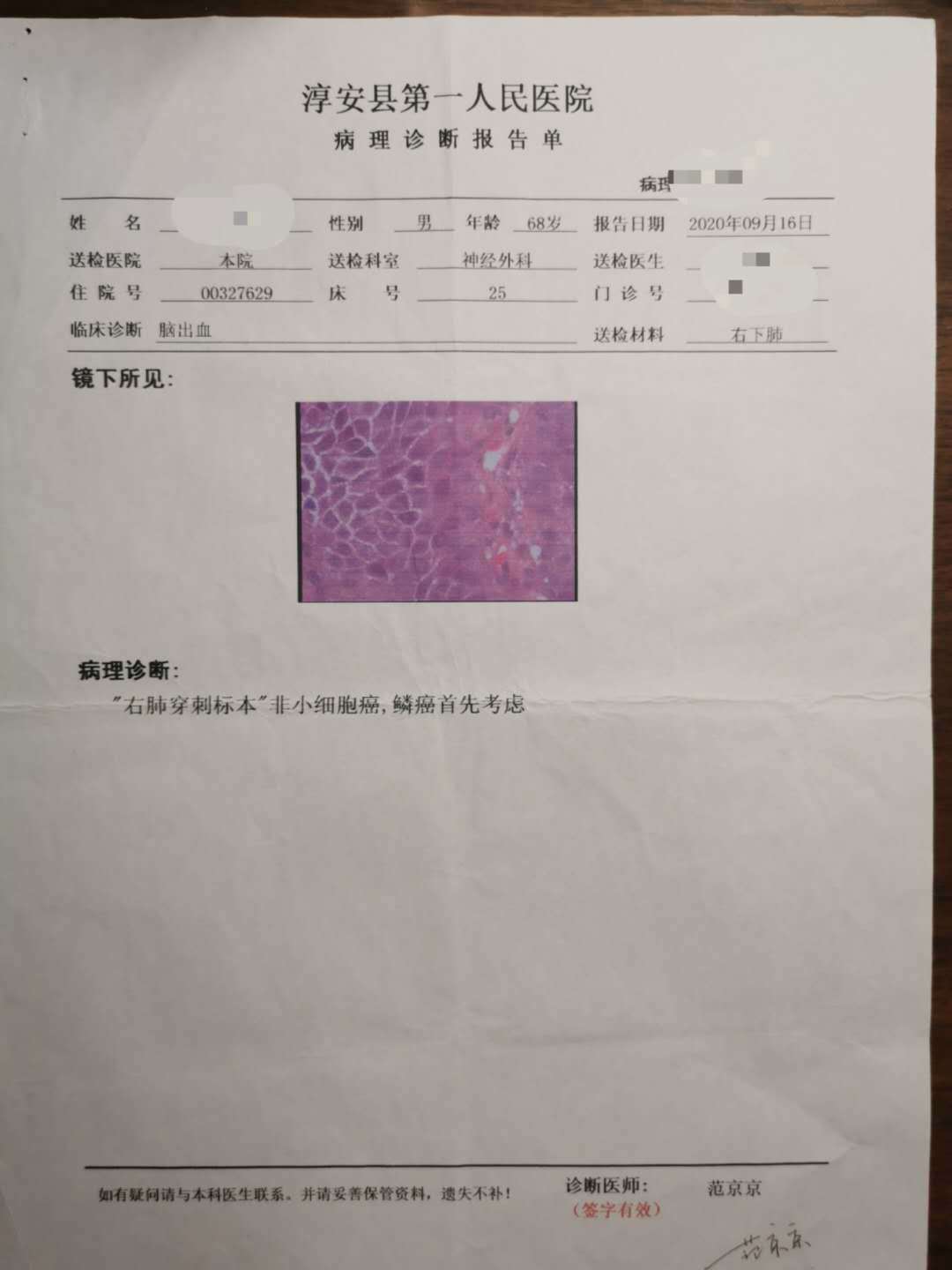 淳安县第一医院出具的关于王冲患有非小细胞型肺鳞癌的诊断书