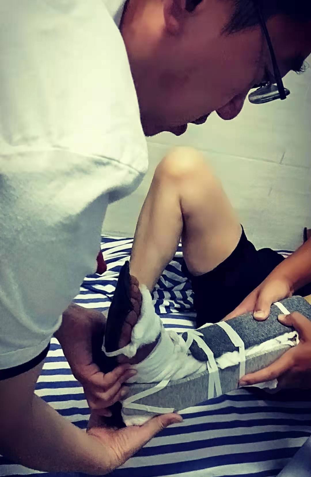 邓氏骨科成功施行一例高龄三踝骨折伴踝关节脱位复位治疗