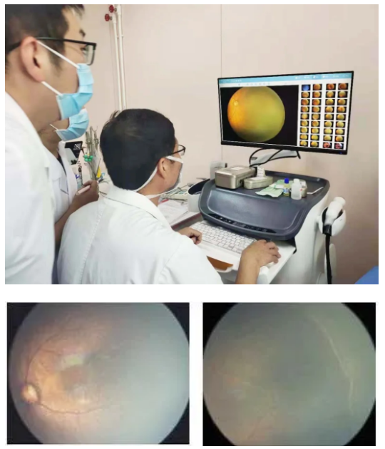 正常视网膜(左图)与早产儿视网膜病变(右图)