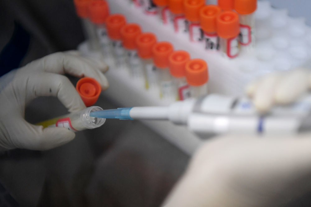 ↑10月21日，兰州大学第二医院检验医学中心检验师刘转在核酸检测实验室内进行核酸提取工作。