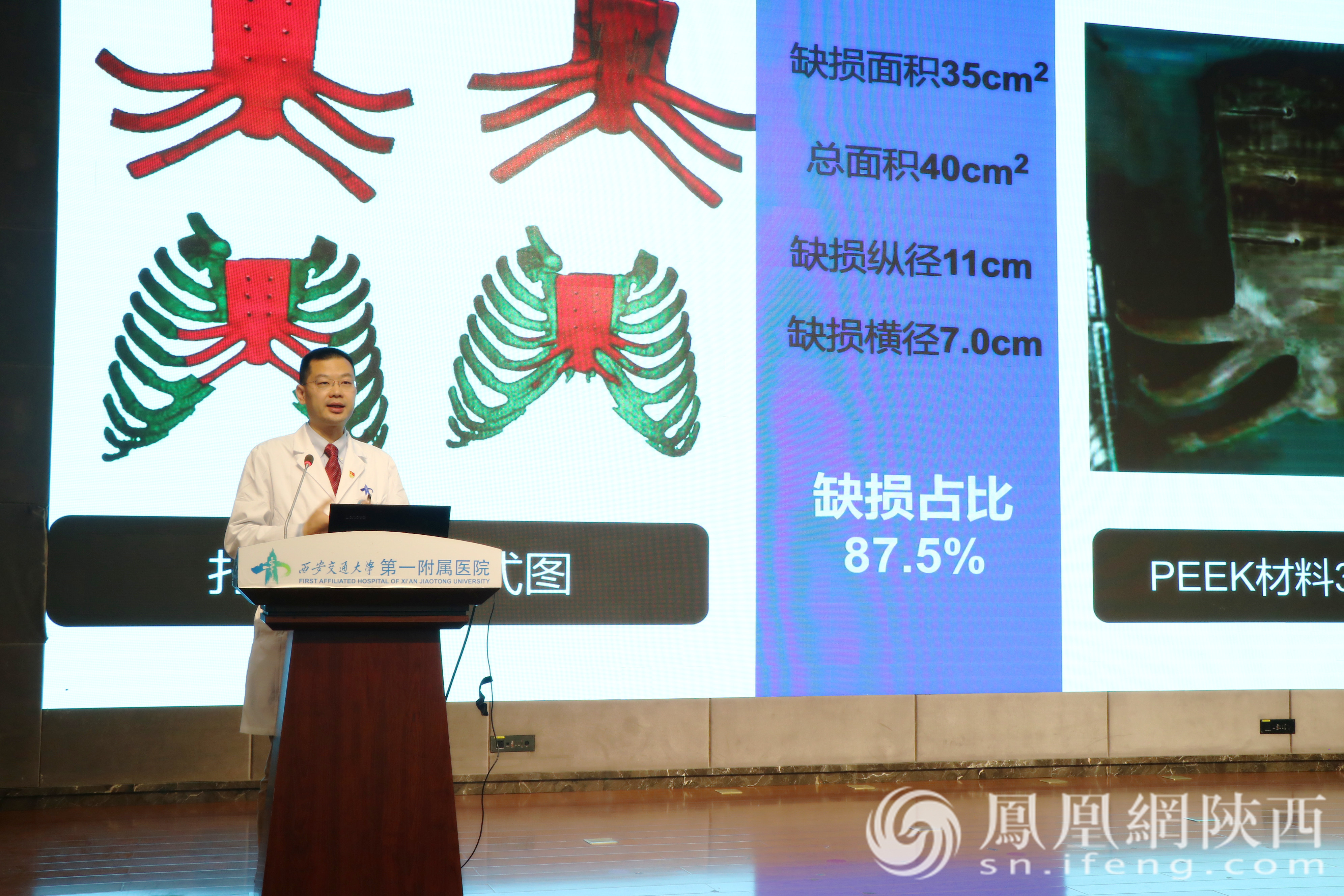 张广健教授介绍治疗患者胸骨相关情况