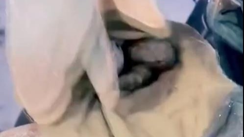 男子看《长津湖》学吃冻土豆 牙齿移位拔掉3颗牙