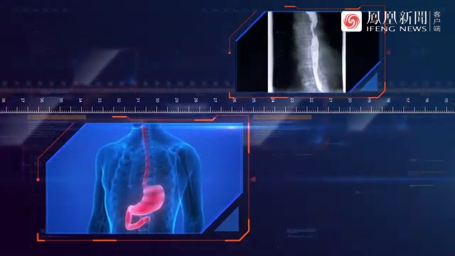 食管的形态与食管癌有密切关系？医生为你解答