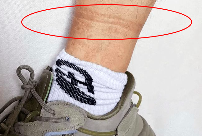 还有的袜子穿上有刺痒,脚腕处勒痕明显等不适感,那说明袜子也不合适