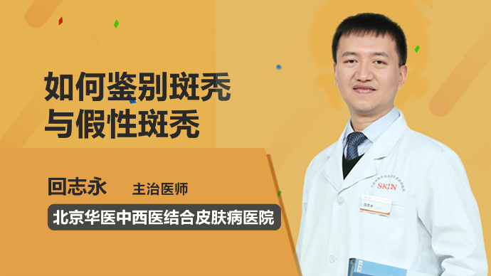 如何鉴别斑秃与假性斑秃？