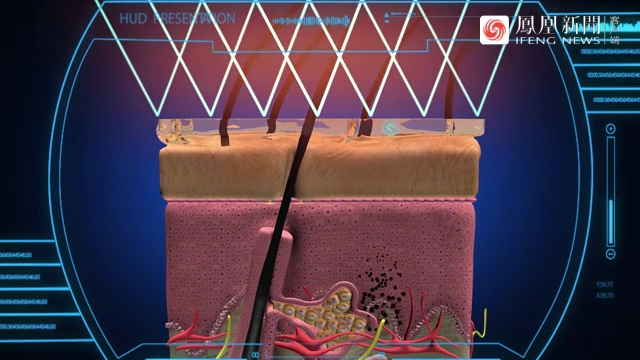 防晒霜能预防黑色素瘤的发生吗？切勿掉以轻心