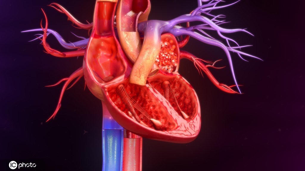 但是心脏也是一个持续高速运转的泵血器官,血流速度很快,绝大多数肿瘤