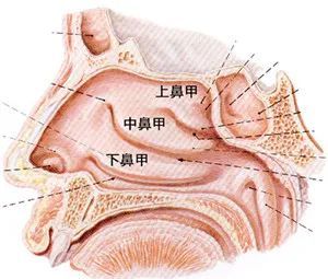 鼻炎患者必读一篇文章教你看懂报告中的鼻甲肥大