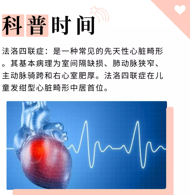 董凤群说胎心：多学科联手护“心”生