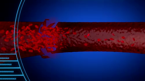 身体里藏着的血瘀，可能是让你患上心血管疾病的罪魁祸首