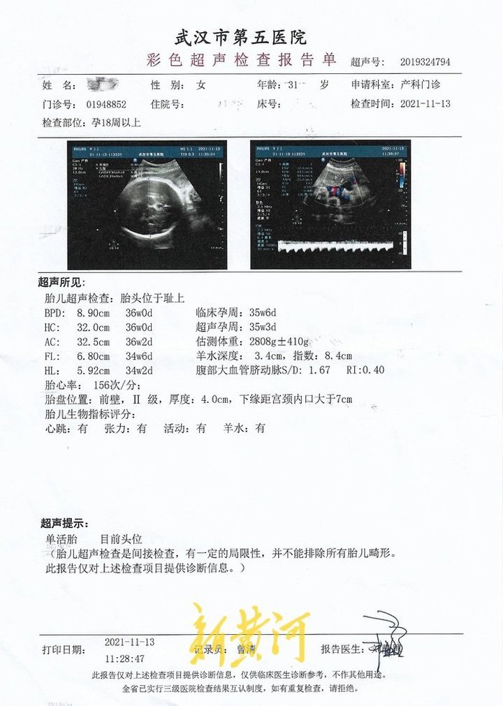 怀孕诊断单图片