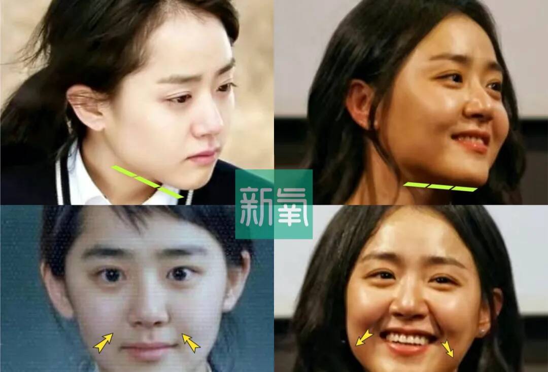 甜茶:别问,问就是发腮了_凤凰网