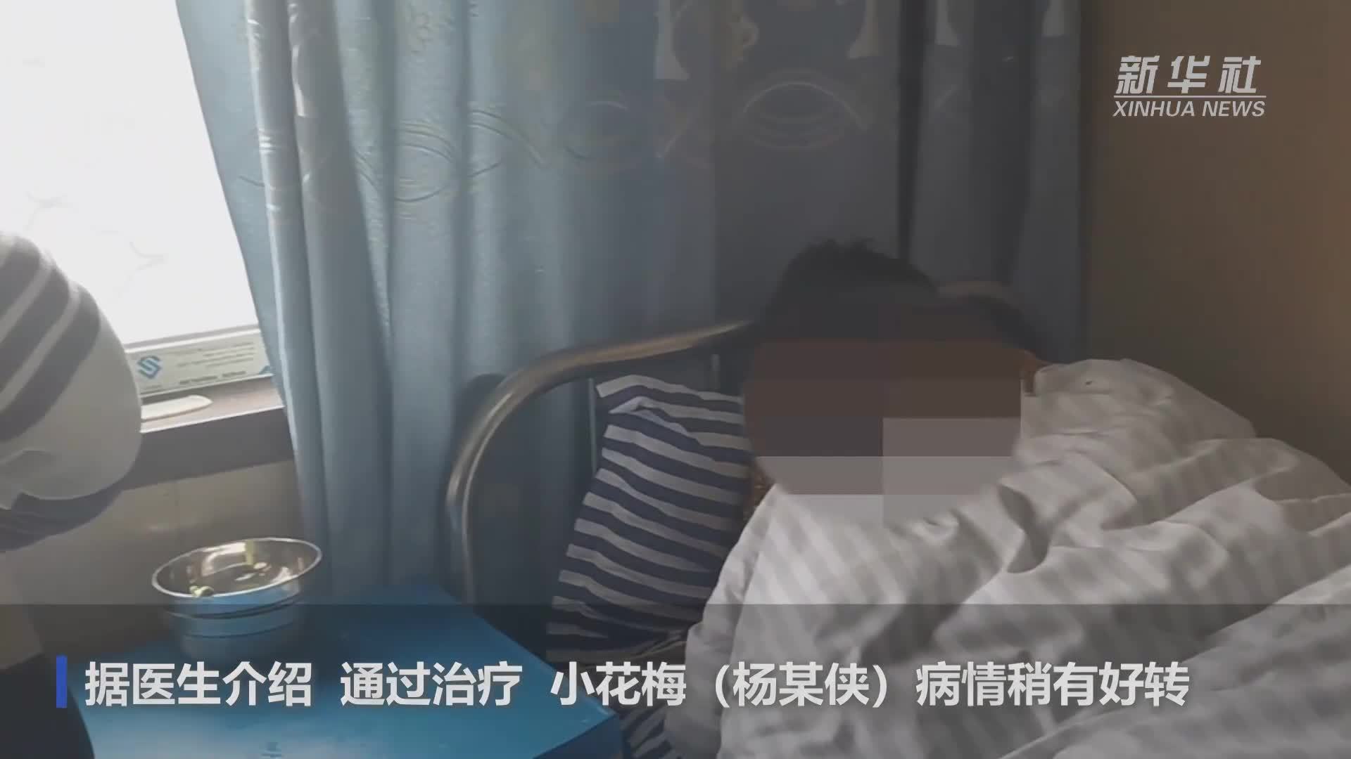 小花梅仍无法回忆过去经历 仅剩9颗牙齿或陆续脱落