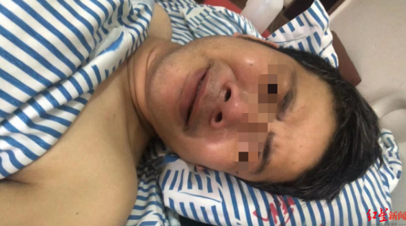 躺在病床上的欧阳自伟