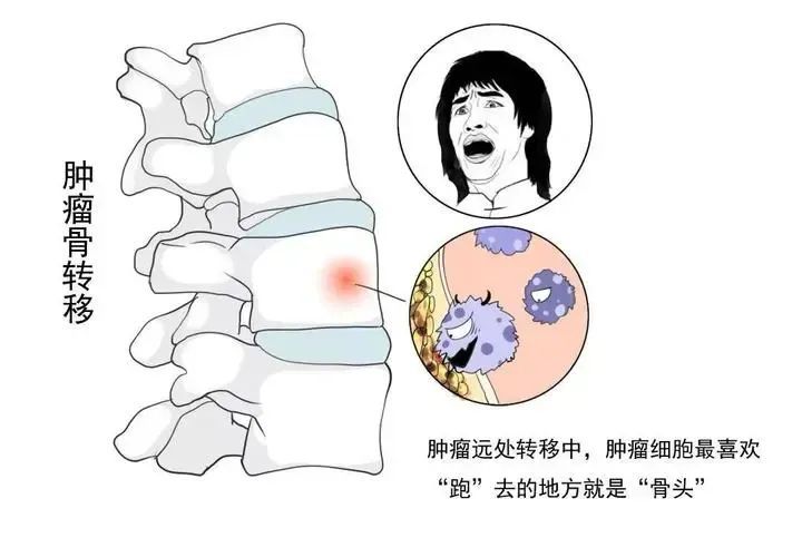 河南省肿瘤医院提醒:小心这些细微差别凤凰网河南