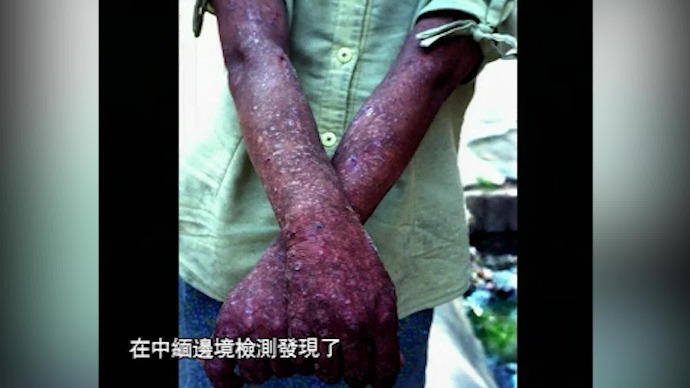 中国艾滋病实录：血之灾|完整版