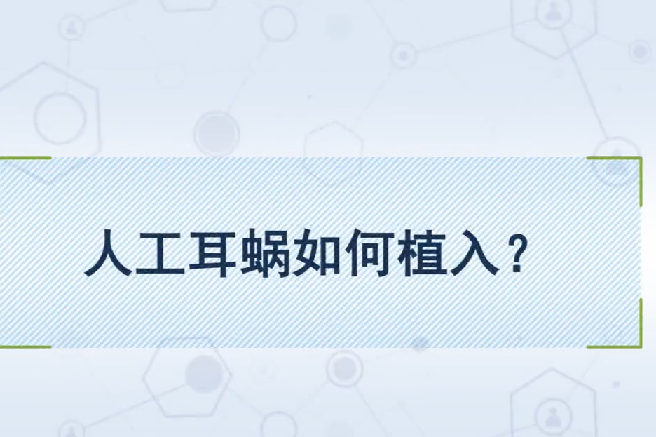 人工耳蜗如何植入？