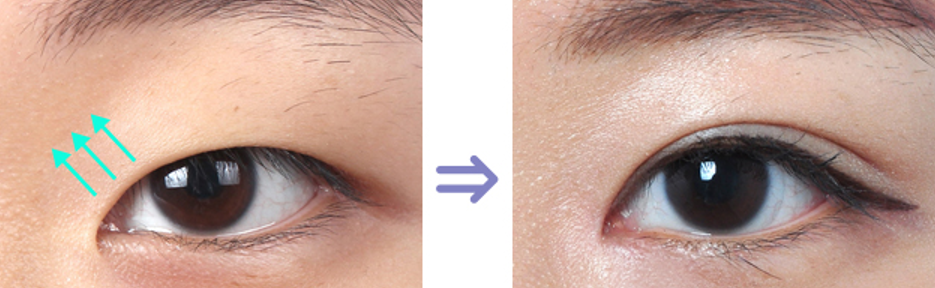 大甜甜和徐睿知的绝绝子上眼角原来是同一个套路