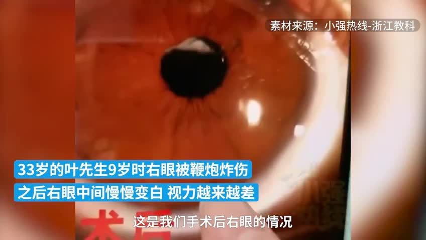 男子9岁时被鞭炮炸伤眼睛，24年后复明