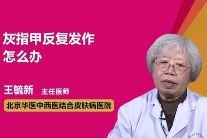 灰指甲反复发作怎么办