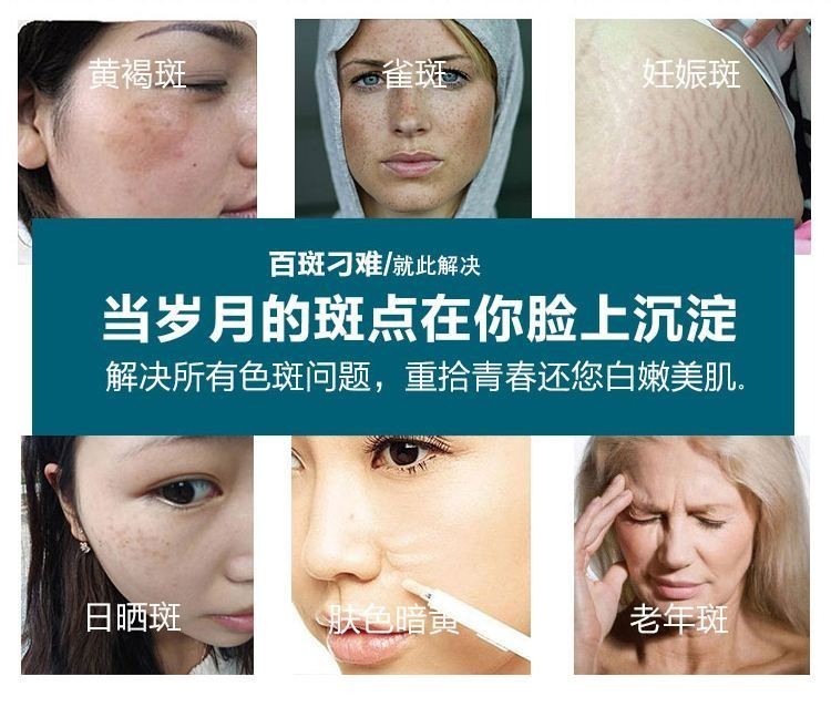 美白祛斑十大品牌，什么牌子的护肤品祛斑美白效果好？