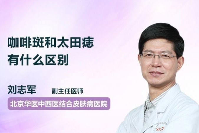 咖啡斑和太田痣有什么区别