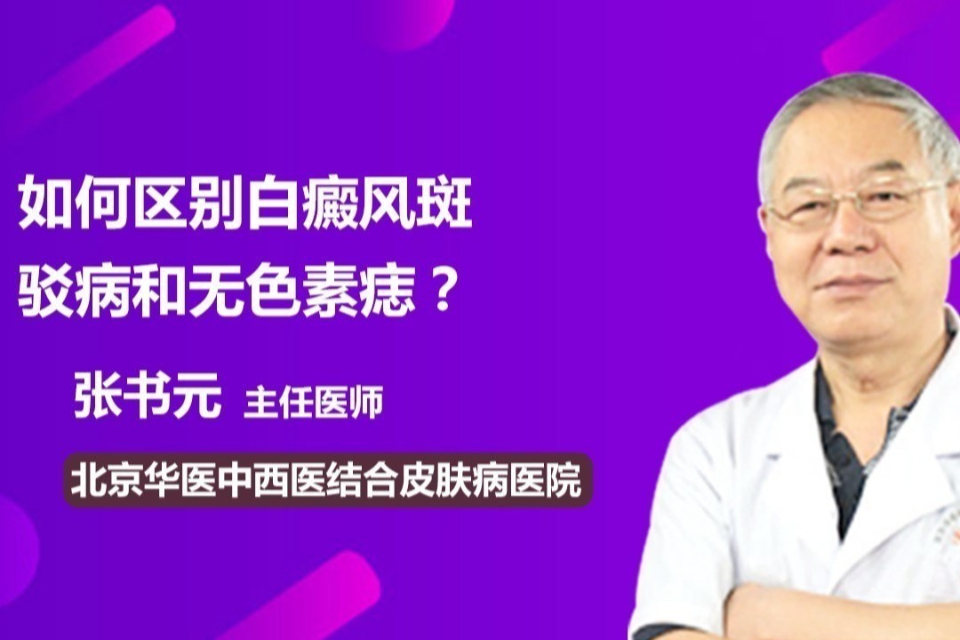 如何区别白癜风斑驳病和无色素痣？