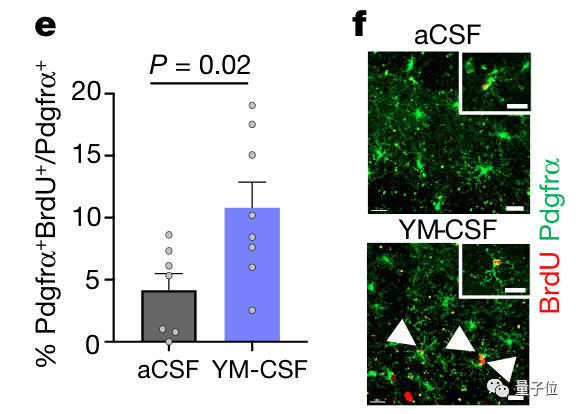 △OPC定量分析及实验图片（f中箭头所指为增殖的OPC）（YM-CSF代表注入年轻脑脊液组，aCSF为对照）