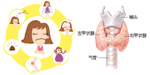 国际甲状腺知识宣传周——山东大学齐鲁医院（青岛）将开展甲状腺疾病多学科义诊活动