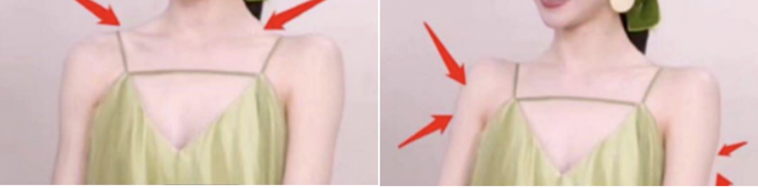 肩颈夹角90°（左），肩关节外观90°（右）