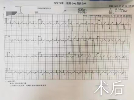 西安市第一医院心血管医院起搏器治疗接轨国际先进水平