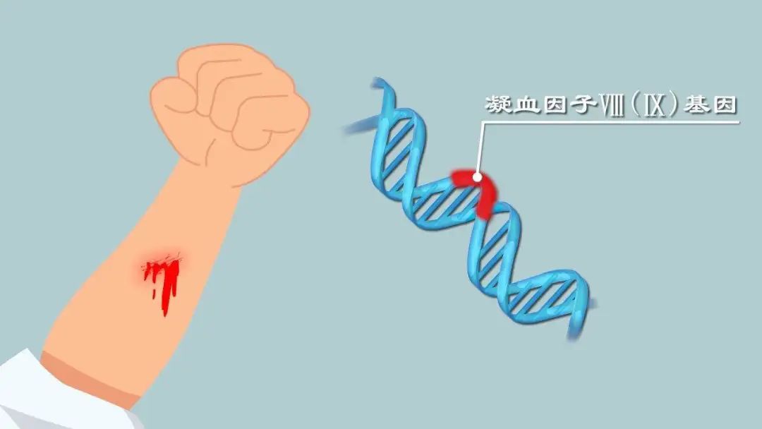 "该血友病患者属于遗传性凝血因子缺乏症,此类患者凝血困难,凝血时间
