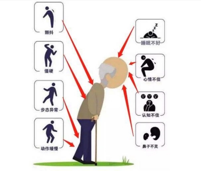 “废物”不废,粪菌移植治疗帕金森病