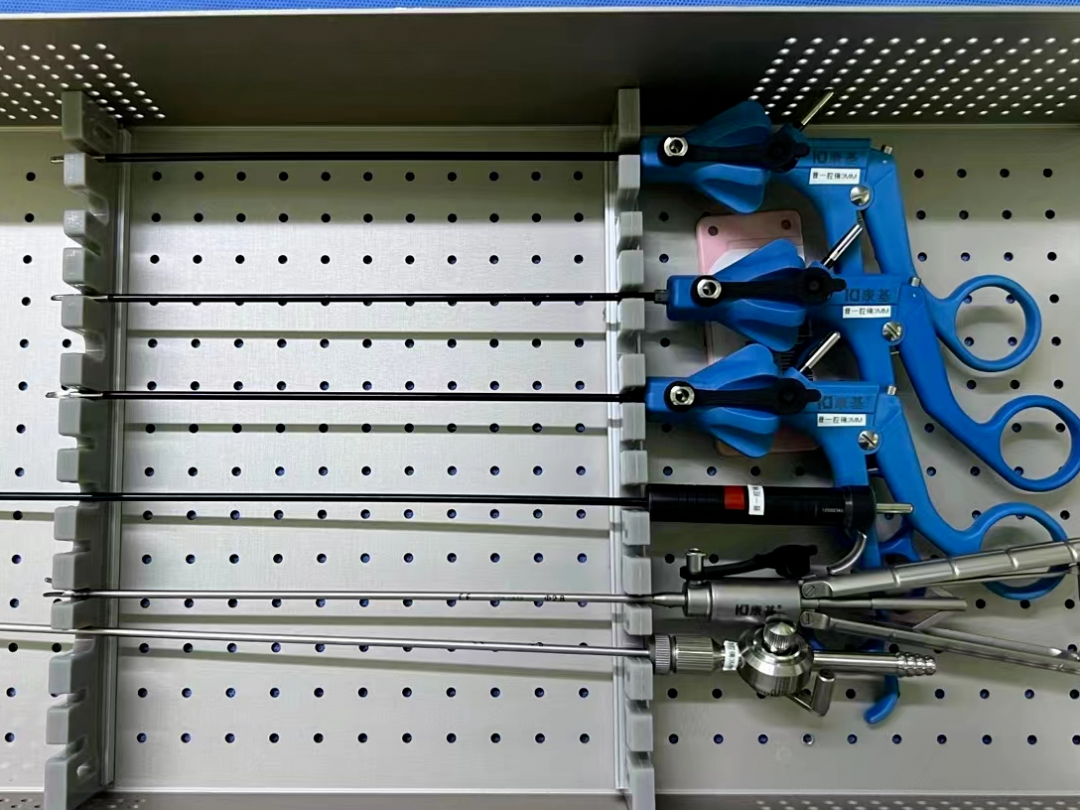 西安市儿童医院完成首例单孔3D腹腔镜下胆总管囊肿根治