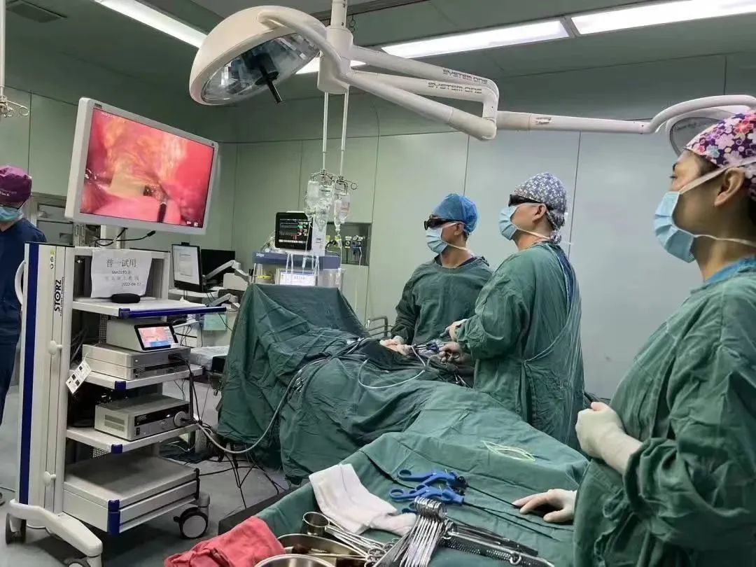 西安市儿童医院完成首例单孔3D腹腔镜下胆总管囊肿根治