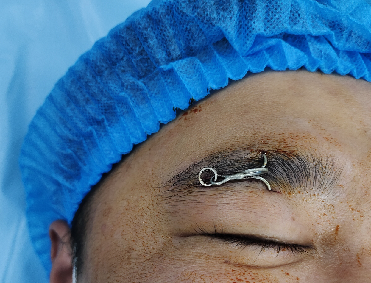 夜钓惊魂鱼钩钩眼