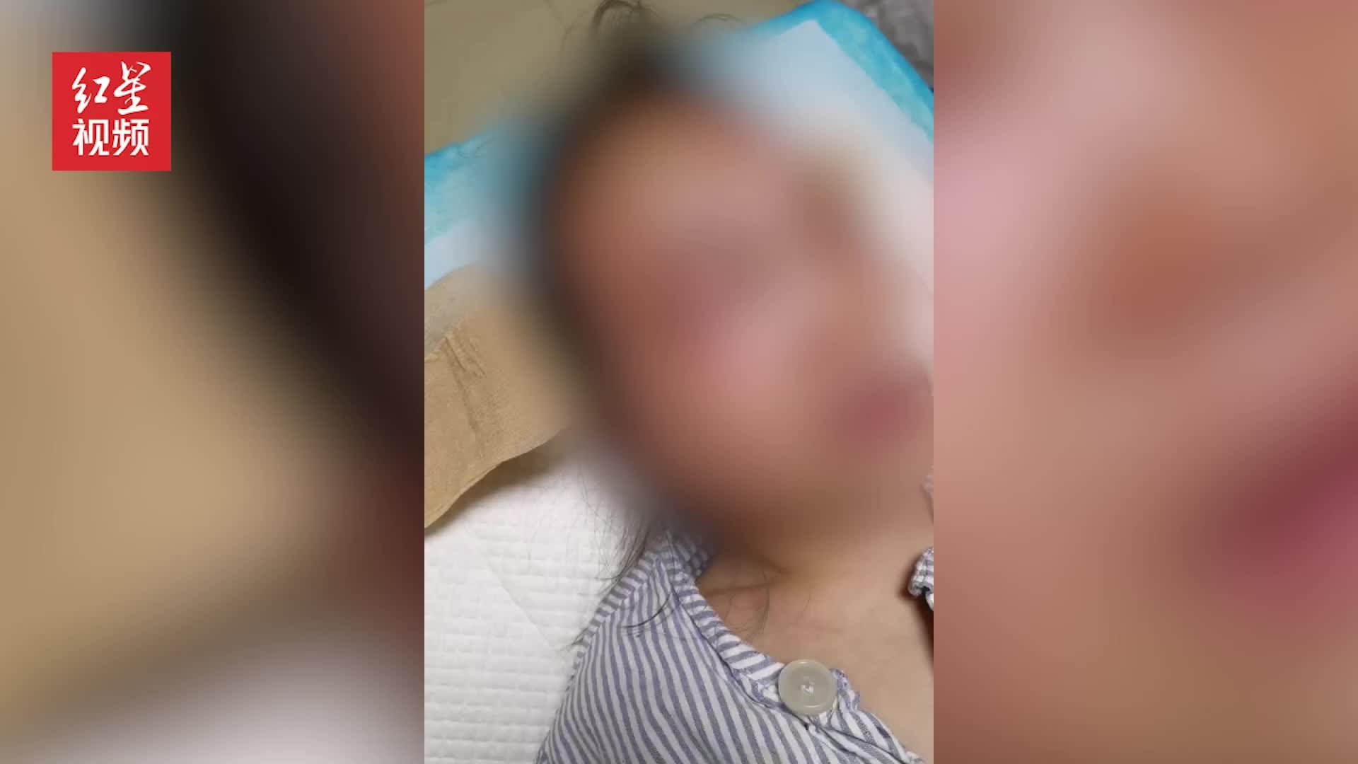 江苏5岁女童遭大型犬咬伤头部面部  当地回应：伤人犬只已被处理，后续事宜相关部门正在调查