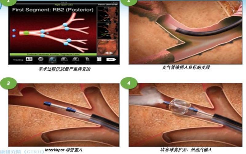 图片由西安交大一附院提供
