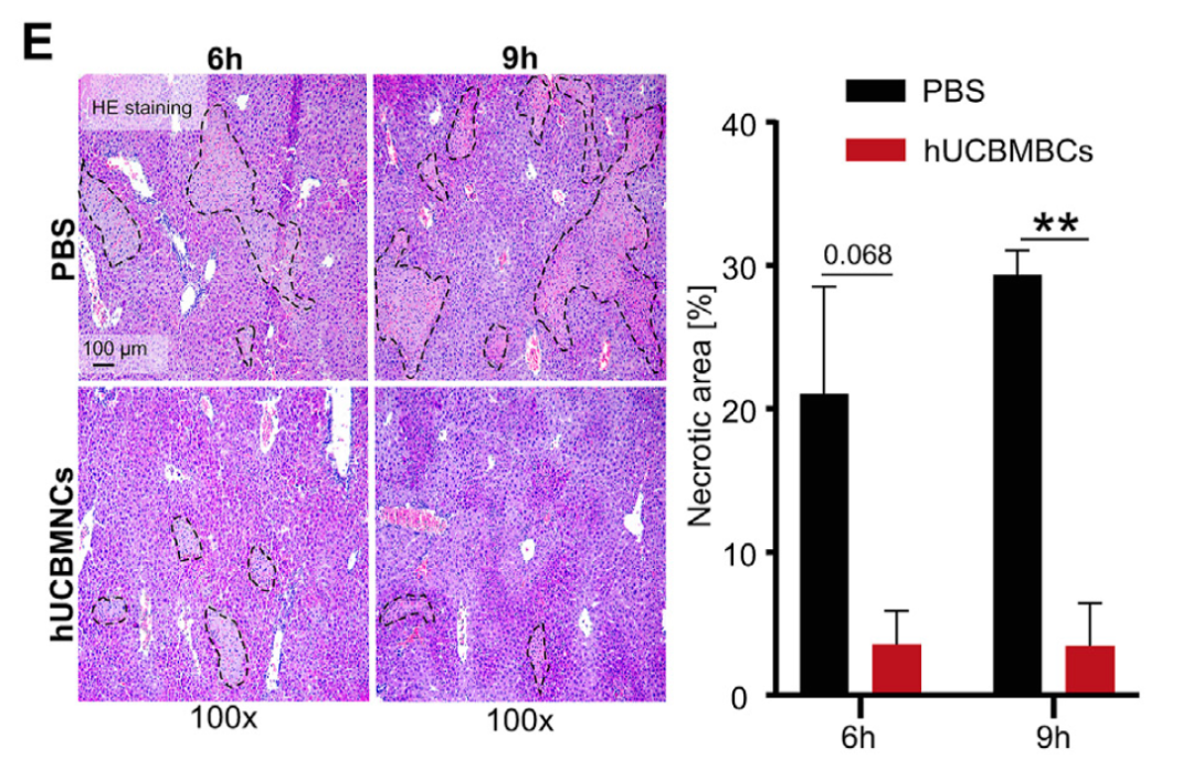 脐带血单个核细胞可显著减少肝坏死区域（黑色圈出部分为坏死区域）
