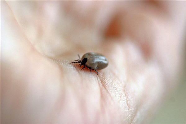 老人头痛竟是被蜱虫连吸数日 终引起脑炎:医生科普“蜱虫伤人”有多可怕