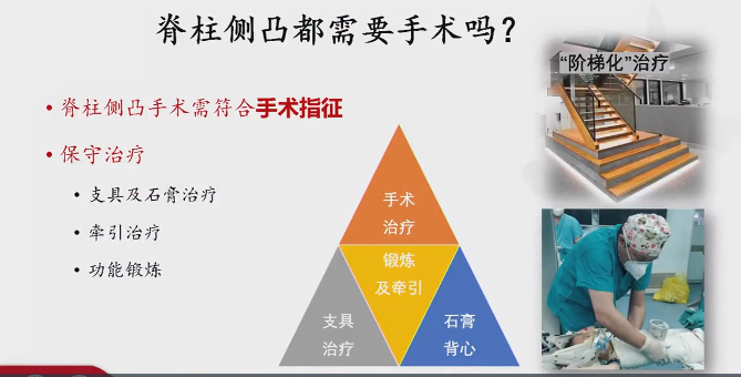世界脊柱日:“蝴蝶飞”特邀朝阳医院骨科专家支招青少年脊柱侧弯
